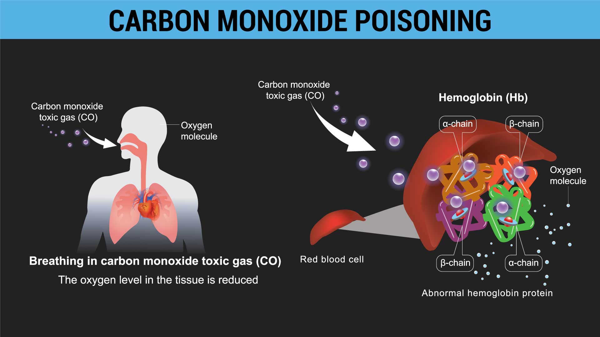 carbon monoxide poisoning in a campervan 02